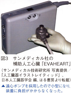 図3　サンメディカル社の補助人工心臓「EVAHEART」